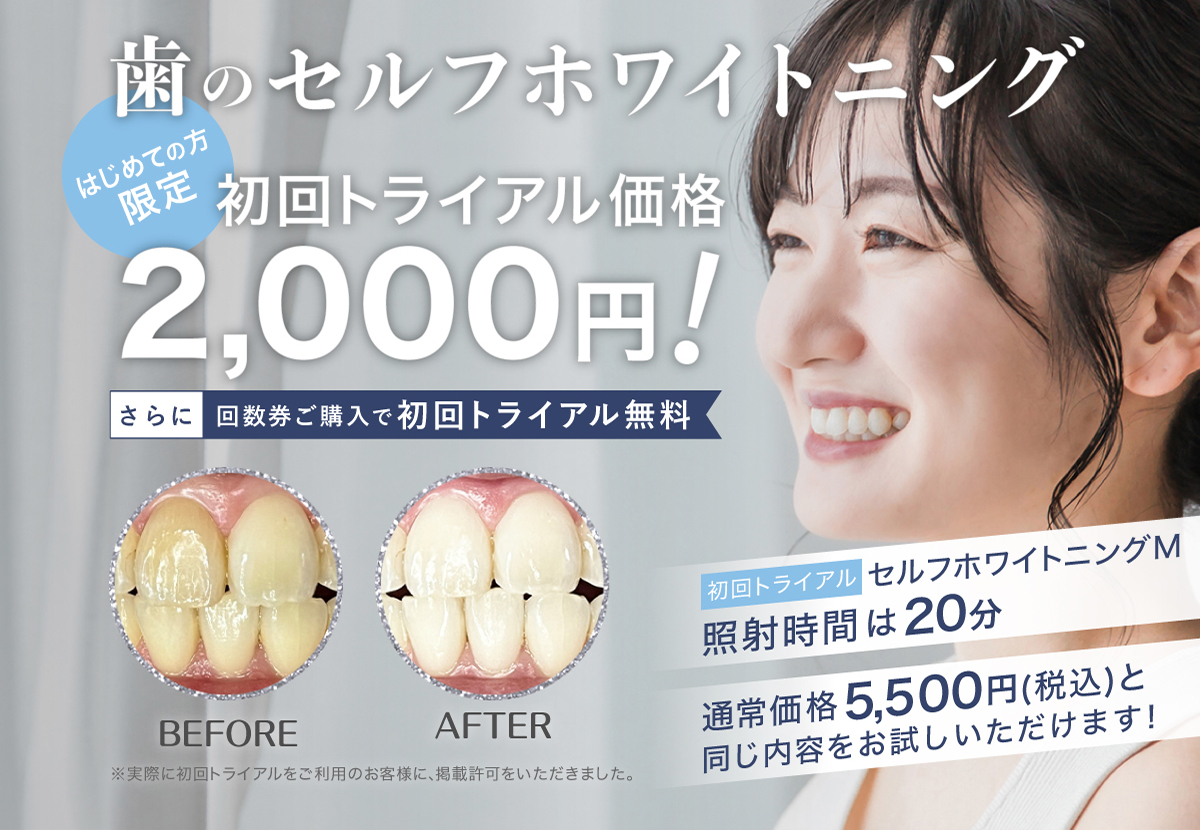 歯のセルフホワイトニング はじめての方限定！初回トライアル2,000円！さらに回数券ご購入で初回トライアル無料！